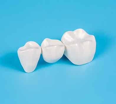 A dental bridge is a prosthetic that replaces missing teeth