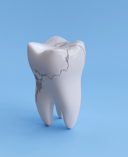 Animated tooth with damage before restorative dentist 