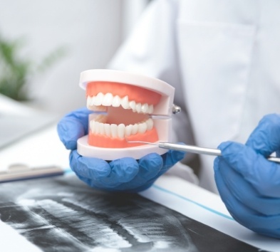 Dentist holding a smile model