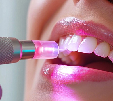 Person receiving laser periodontal treatment