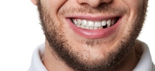 Smiling patient with missing tooth before replacement