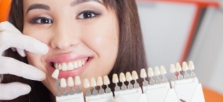 Patient's smile compared with tooth color chart