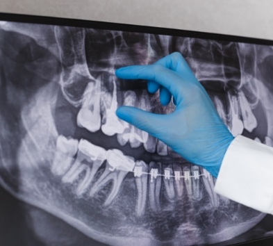 Dentist reviewing digital x-rays