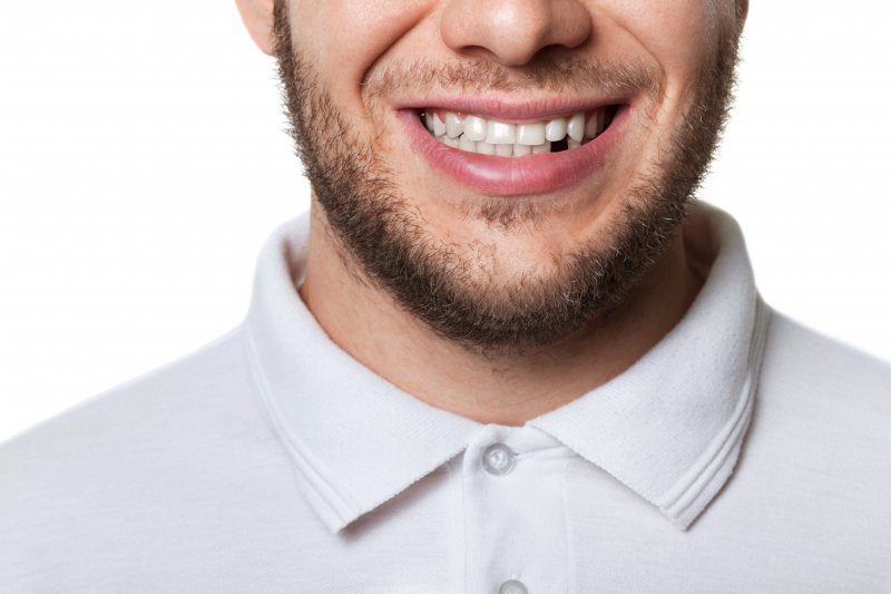 man smiling with missing teeth 
