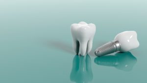 Tooth and dental implant on blue background